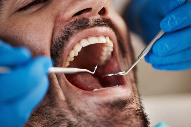 Best Emergency Gum Treatment in Six Mile Run, NJ
