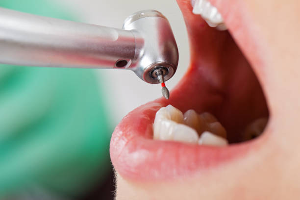 Best Emergency Treatment for Dental Infections or Abscesses in Six Mile Run, NJ
